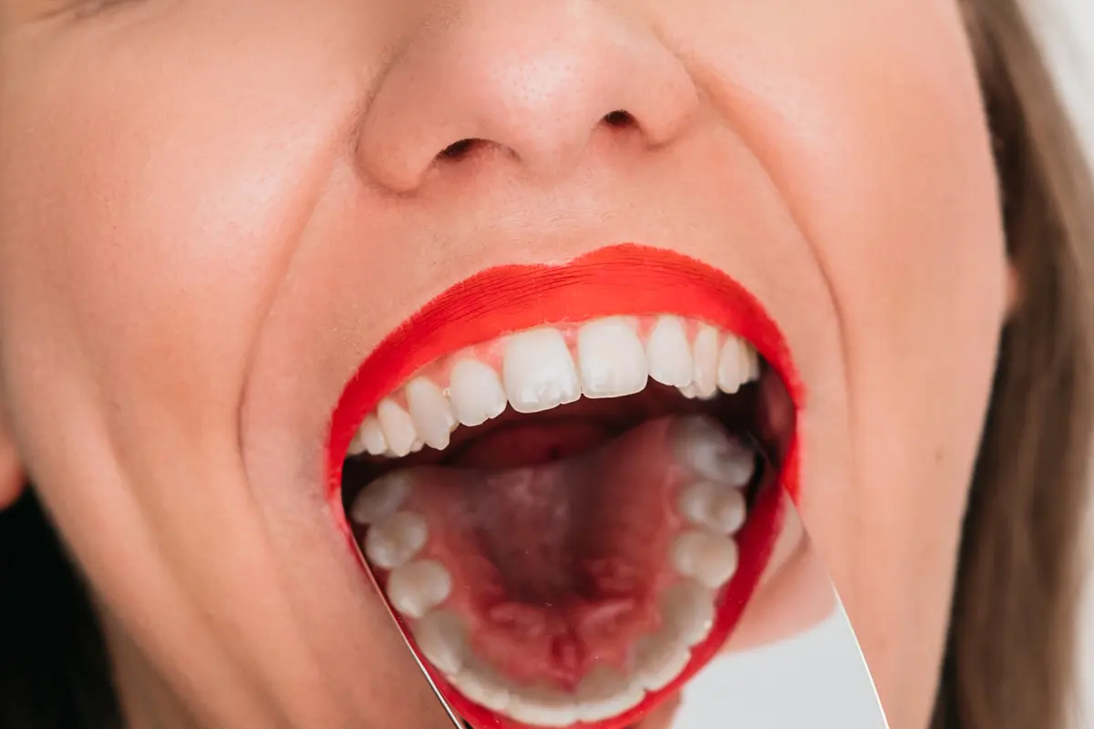 Pregled zuba i desni u ordinaciji Dental Centar Apex