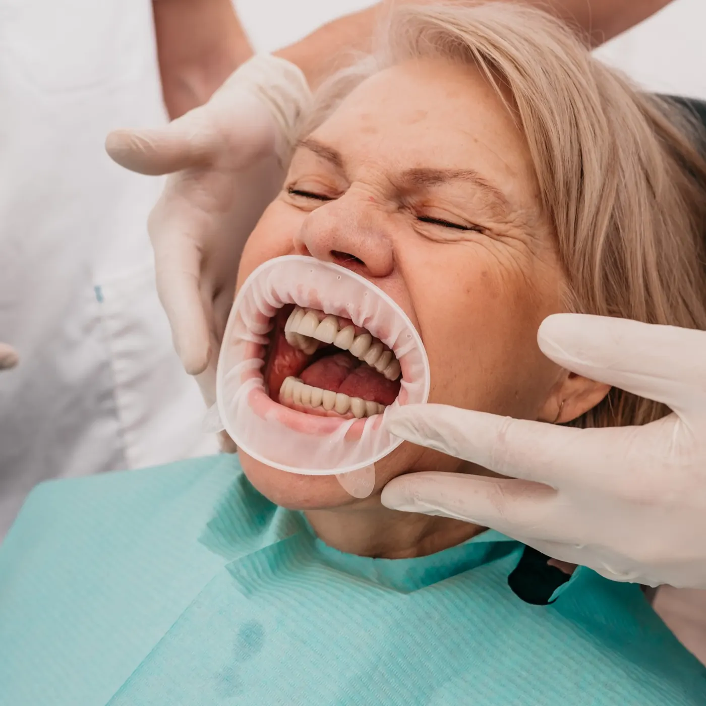 Galerija osmijeha – rezultati estetske stomatologije Dental Centar Apex